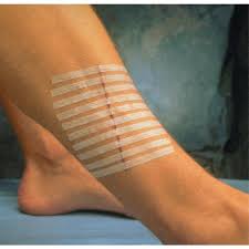 Sutures cutanées stériles